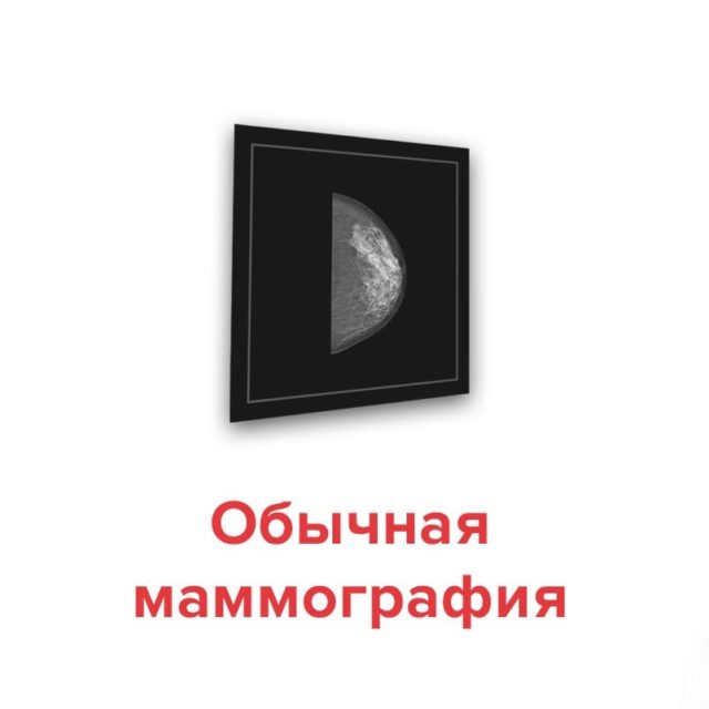 сделать маммографию в хабаровске